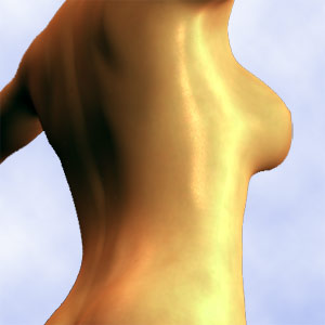 Preventing Breast Cancer Recurrence