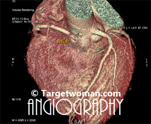 64 slice CT Angiogram
