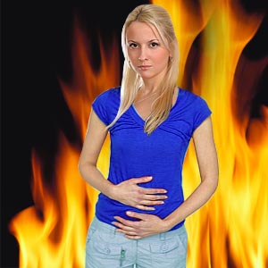 Acid Reflux Syndrome