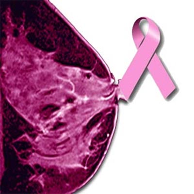 Breast Density and Breast Cancer Risk