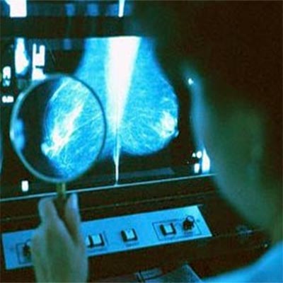 Diagnostic mammogram