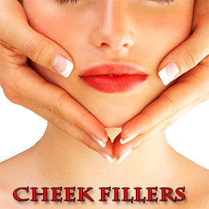 Cheek Fillers