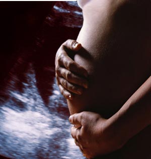 Ectopic Pregnancy