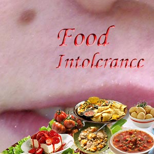 Food Intolerance