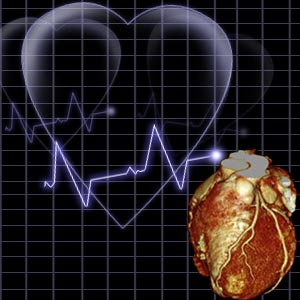 Framingham Heart Study Risk