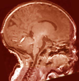 Infant Brain Development