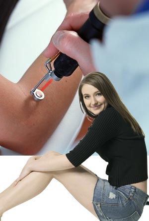 Laser Hair Removal