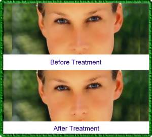 Facial Cosmetic Surgery