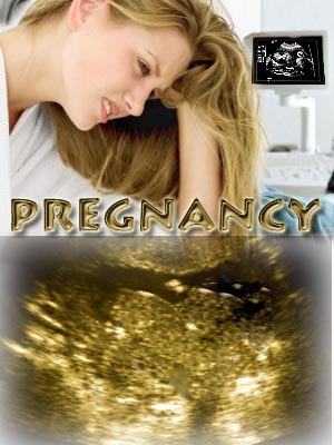 Molar Pregnancy