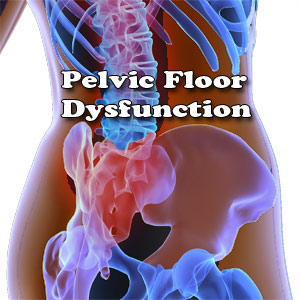 Pelvic Floor Dysfunction