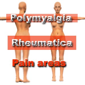 Polymyalgia Rheumatica