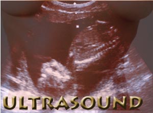 Pregnancy Ultrasound