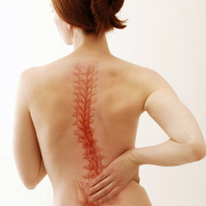 Scoliosis Treatment