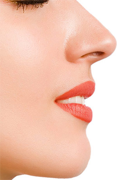 Chemical Skin Peels